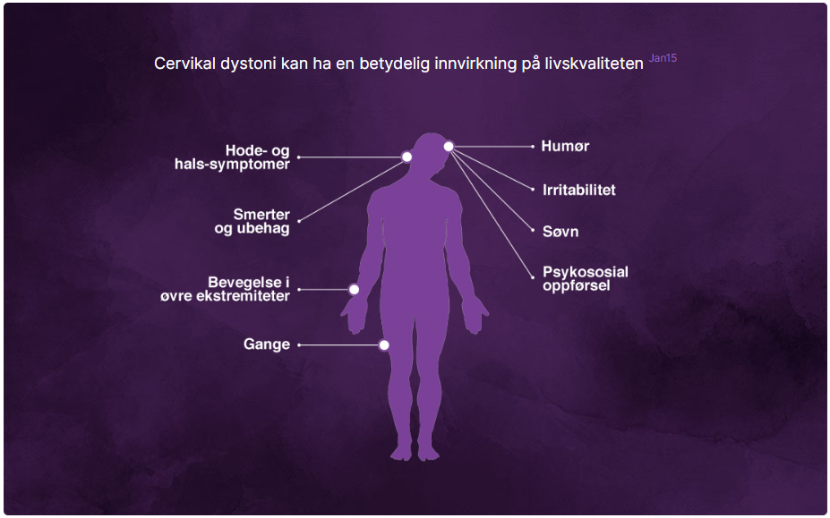 BOTOX-indikasjon: Cervikal dystoni